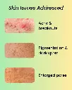 4.webp